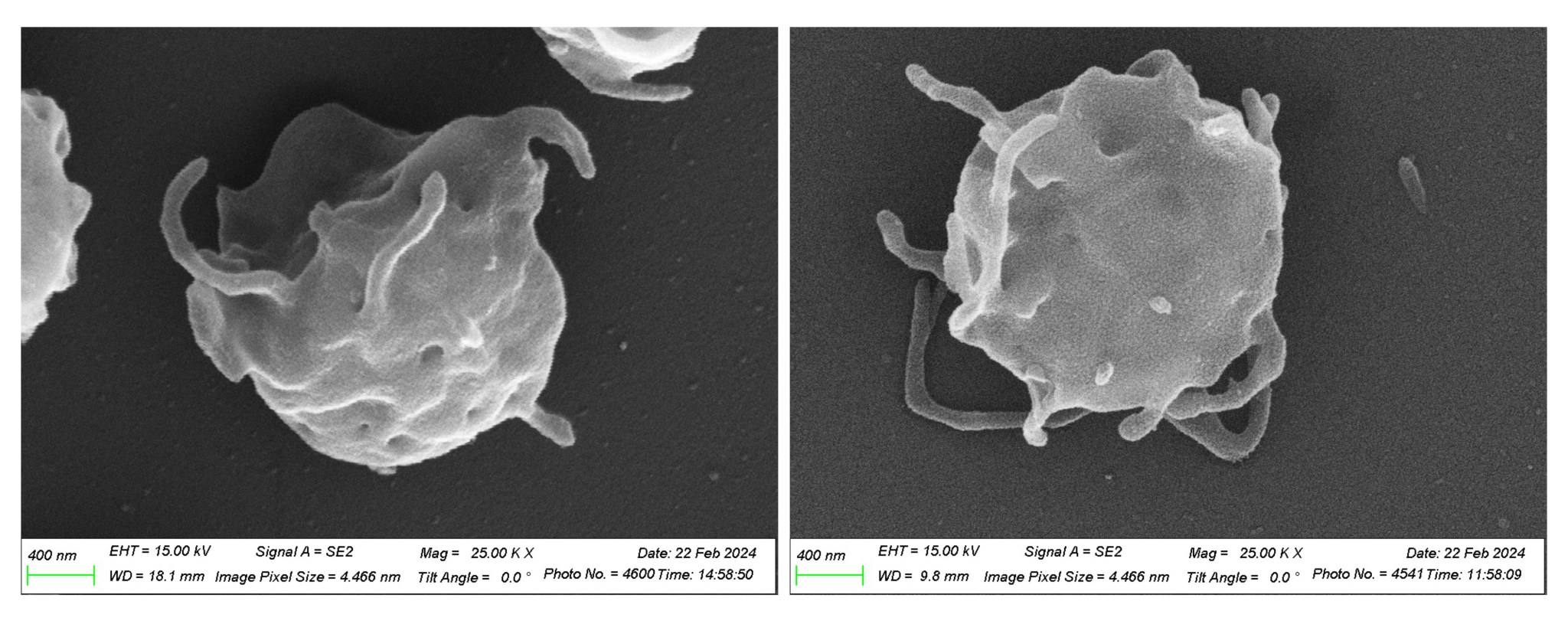 Two side-by-side black and white images show highly magnified individual platelets, which are roundish, pockmarked spheres with several small, arm-like protrusions.